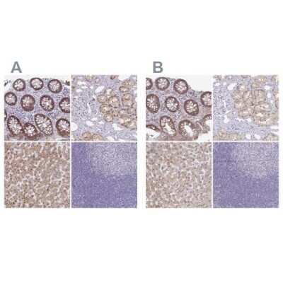 Immunohistochemistry: Rabbit anti-Llama VHH Secondary Antibody [DyLight 550] [NBP2-95273R] - Test125
